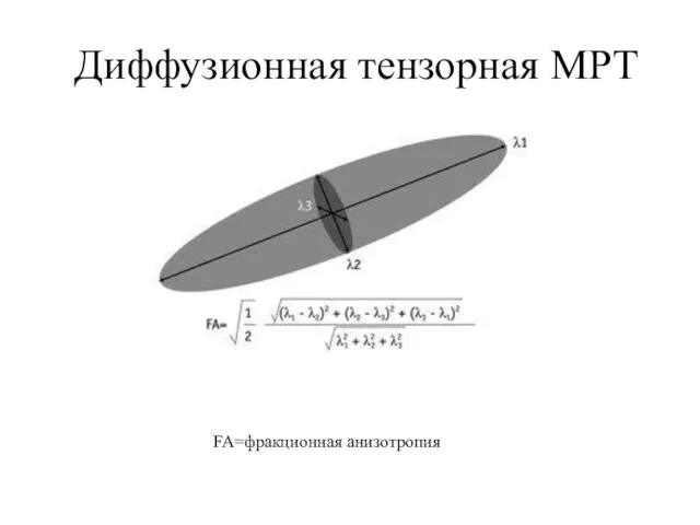 Диффузионная тензорная МРТ FA=фракционная анизотропия