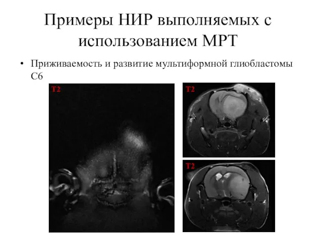 Примеры НИР выполняемых с использованием МРТ Приживаемость и развитие мультиформной глиобластомы С6 T2 T2 T2