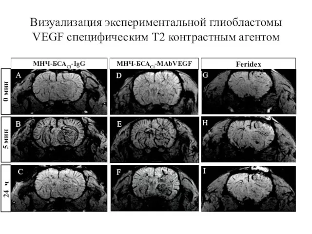 Визуализация экспериментальной глиобластомы VEGF специфическим T2 контрастным агентом