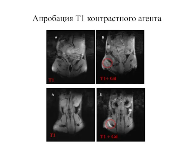 T1 T1 T1+ Gd T1 + Gd Апробация Т1 контрастного агента