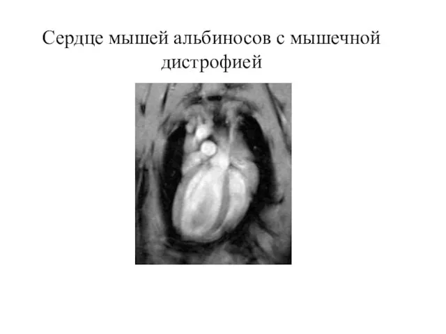 Сердце мышей альбиносов с мышечной дистрофией