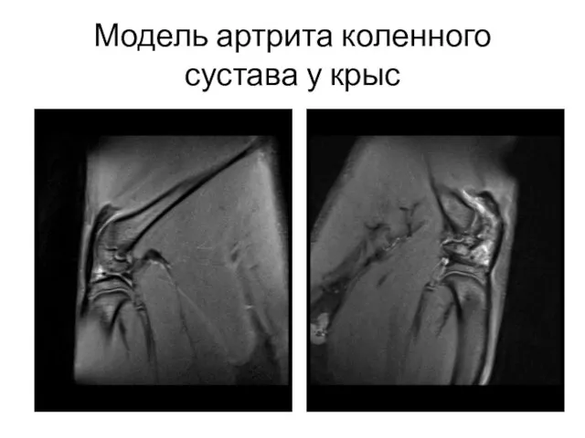 Модель артрита коленного сустава у крыс