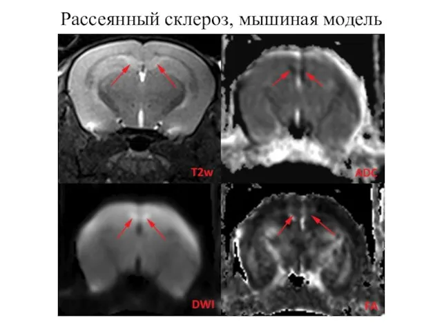 Рассеянный склероз, мышиная модель