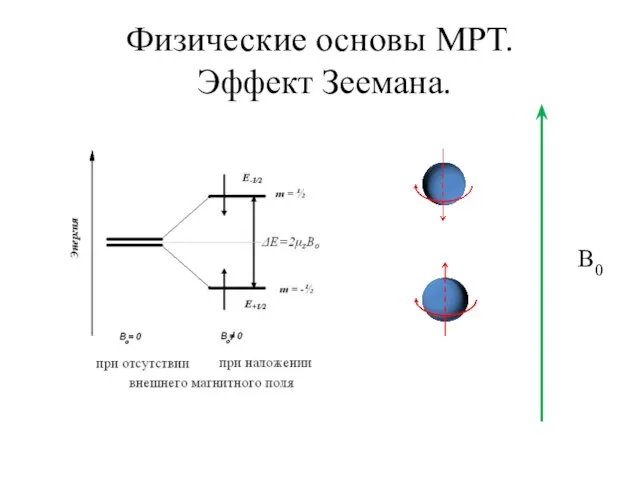 Физические основы МРТ. Эффект Зеемана. B0