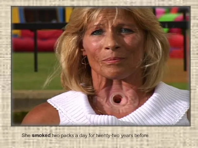 She smoked two packs a day for twenty-two years before