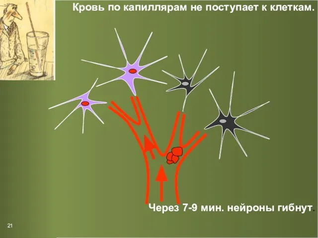 Кровь по капиллярам не поступает к клеткам. Через 7-9 мин. нейроны гибнут. 21