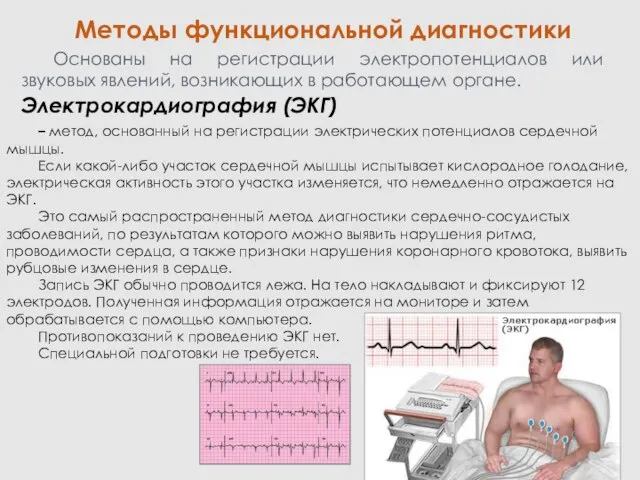 Методы функциональной диагностики – метод, основанный на регистрации электрических потенциалов сердечной мышцы.