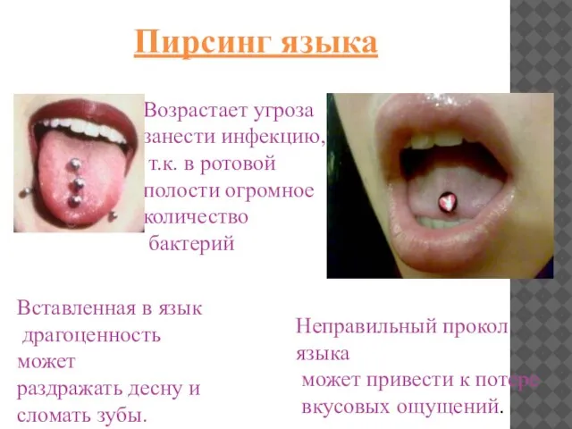 Пирсинг языка Возрастает угроза занести инфекцию, т.к. в ротовой полости огромное количество