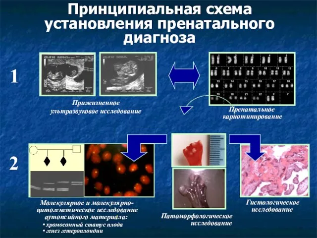 Принципиальная схема установления пренатального диагноза 1 2