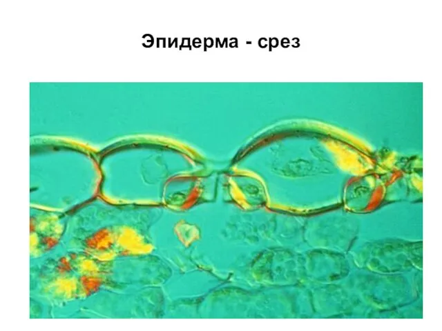 Эпидерма - срез