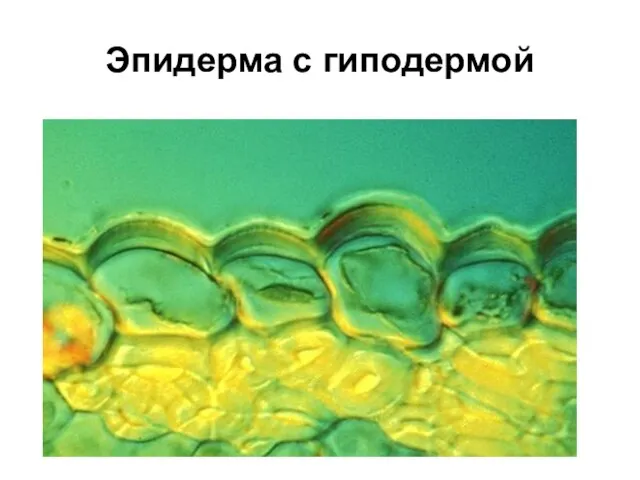 Эпидерма с гиподермой