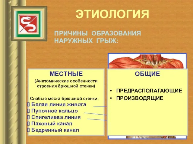 ЭТИОЛОГИЯ МЕСТНЫЕ (Анатомические особенности строения брюшной стенки) Слабые места брюшной стенки: Белая