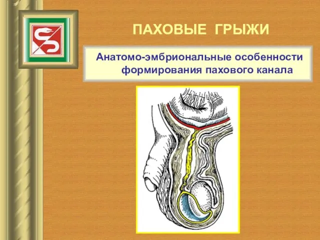 ПАХОВЫЕ ГРЫЖИ Анатомо-эмбриональные особенности формирования пахового канала