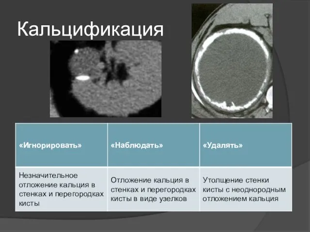 Кальцификация