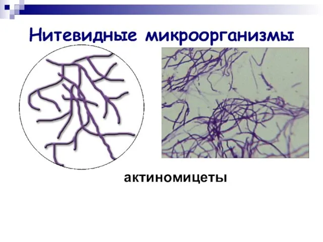 Нитевидные микроорганизмы актиномицеты