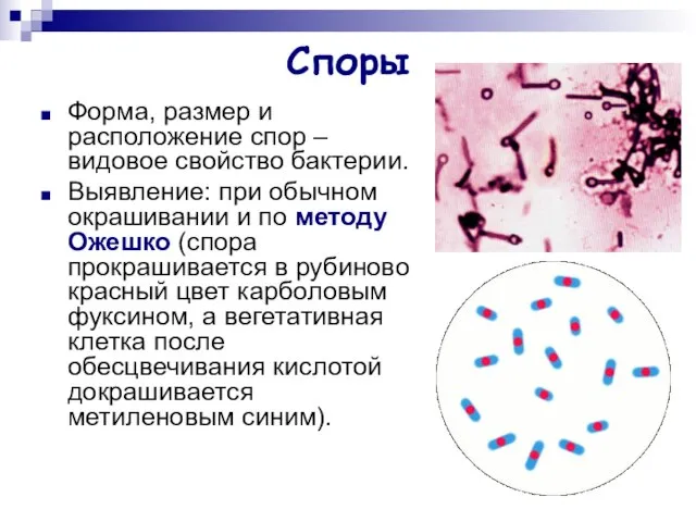 Споры Форма, размер и расположение спор – видовое свойство бактерии. Выявление: при