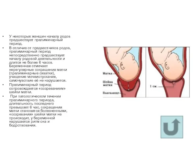 У некоторых женщин началу родов предшествует прелиминарный период. В отличие от предвестников