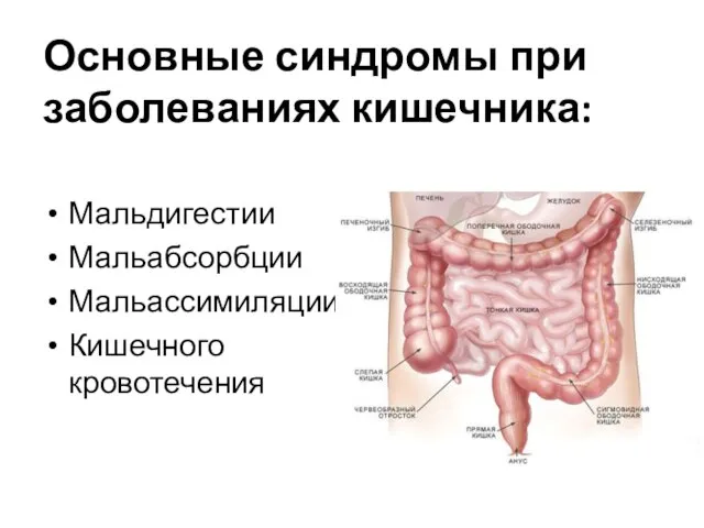 Основные синдромы при заболеваниях кишечника: Мальдигестии Мальабсорбции Мальассимиляции Кишечного кровотечения