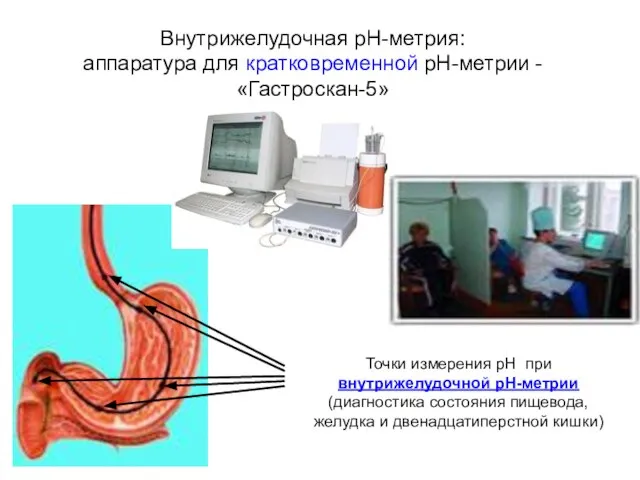 Точки измерения рН при внутрижелудочной pH-метрии (диагностика состояния пищевода, желудка и двенадцатиперстной