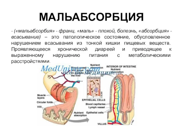 МАЛЬАБСОРБЦИЯ - («мальабсорбия» - франц. «маль» - плохой, болезнь, «абсорбция» - всасывание)