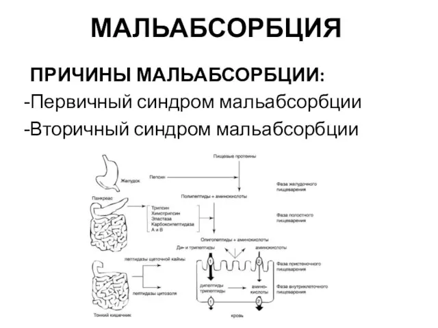 МАЛЬАБСОРБЦИЯ ПРИЧИНЫ МАЛЬАБСОРБЦИИ: Первичный синдром мальабсорбции Вторичный синдром мальабсорбции