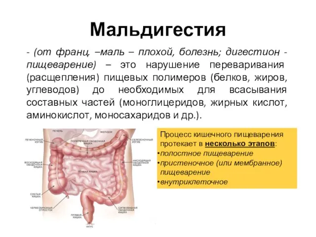 Мальдигестия - (от франц. –маль – плохой, болезнь; дигестион - пищеварение) –