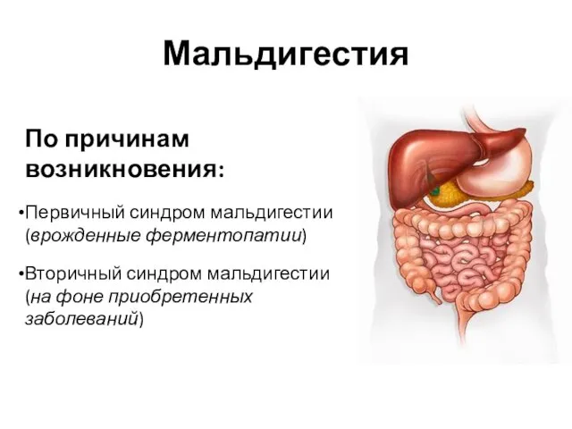 Мальдигестия По причинам возникновения: Первичный синдром мальдигестии (врожденные ферментопатии) Вторичный синдром мальдигестии (на фоне приобретенных заболеваний)