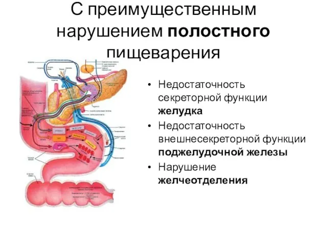 С преимущественным нарушением полостного пищеварения Недостаточность секреторной функции желудка Недостаточность внешнесекреторной функции поджелудочной железы Нарушение желчеотделения