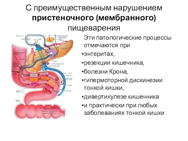 С преимущественным нарушением пристеночного (мембранного) пищеварения Эти патологические процессы отмечаются при энтеритах,