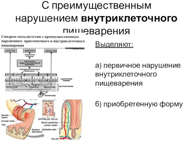 С преимущественным нарушением внутриклеточного пищеварения Выделяют: а) первичное нарушение внутриклеточного пищеварения б) приобретенную форму