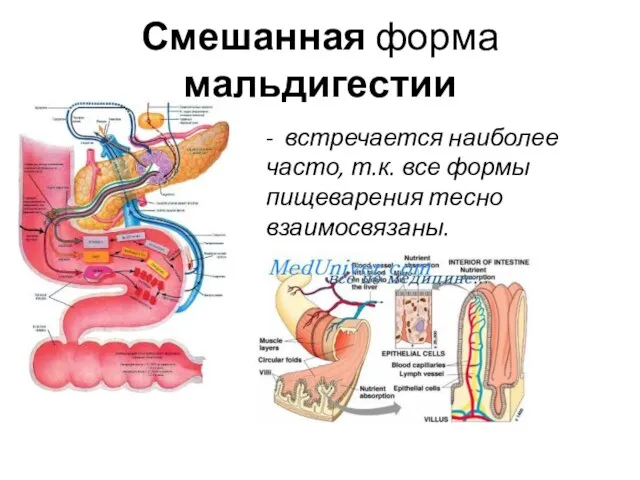 Смешанная форма мальдигестии - встречается наиболее часто, т.к. все формы пищеварения тесно взаимосвязаны.