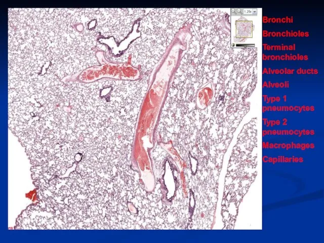 Bronchi Bronchioles Terminal bronchioles Alveolar ducts Alveoli Type 1 pneumocytes Type 2 pneumocytes Macrophages Capillaries