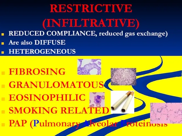 RESTRICTIVE (INFILTRATIVE) REDUCED COMPLIANCE, reduced gas exchange) Are also DIFFUSE HETEROGENEOUS FIBROSING