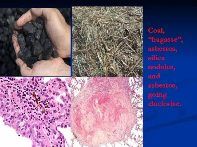 Coal, “bagasse”, asbestos, silica nodules, and asbestos, going clockwise.