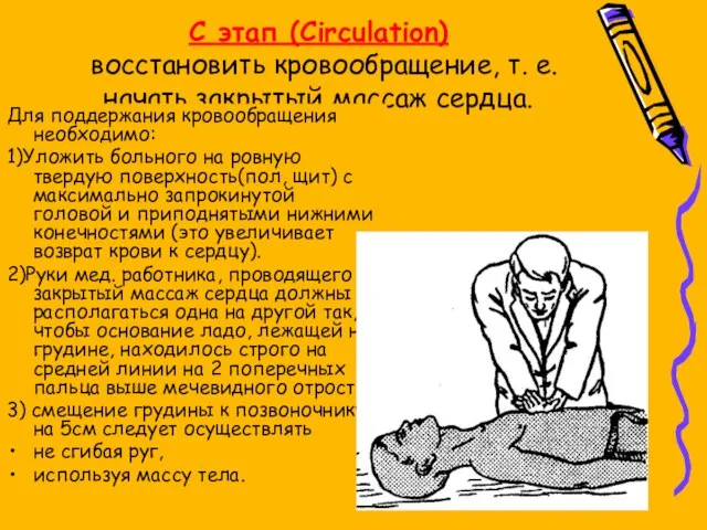 C этап (Circulation) восстановить кровообращение, т. е. начать закрытый массаж сердца. Для