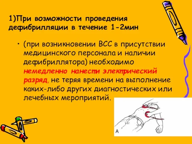 1)При возможности проведения дефибрилляции в течение 1-2мин (при возникновении ВСС в присутствии