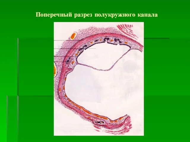 Поперечный разрез полукружного канала