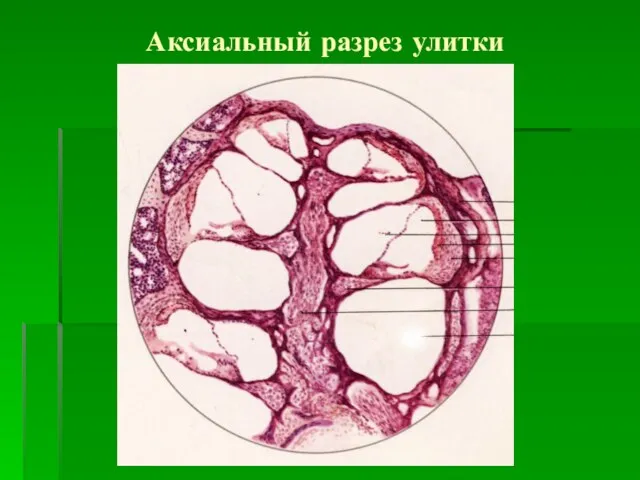 Аксиальный разрез улитки