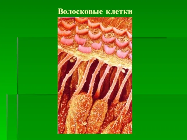 Волосковые клетки