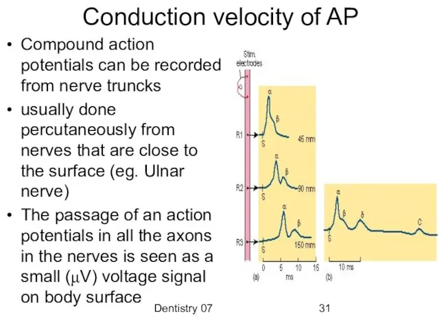 Dentistry 07 Conduction velocity of AP Compound action potentials can be recorded