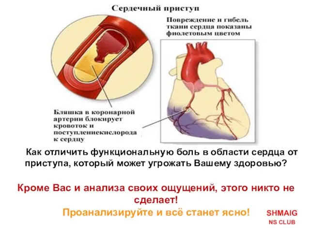 Как отличить функциональную боль в области сердца от приступа, который может угрожать