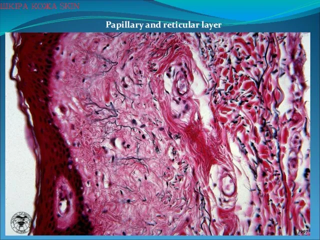 Papillary and reticular layer ШКІРА КОЖА SKIN