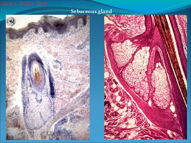 Sebaceous gland ШКІРА КОЖА SKIN