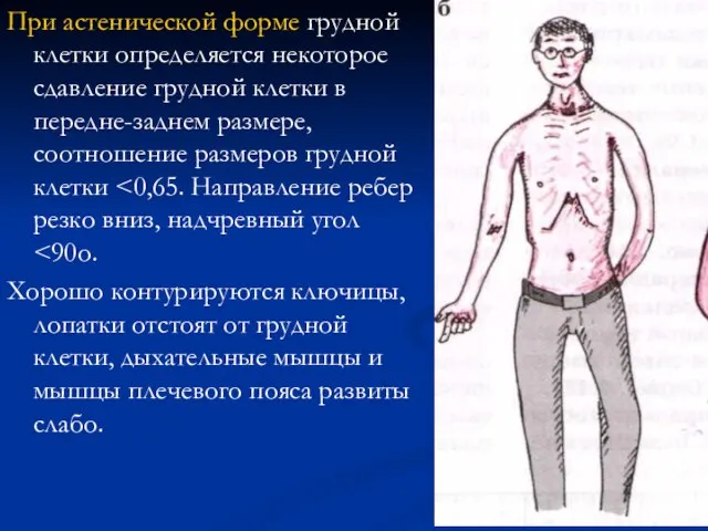 При астенической форме грудной клетки определяется некоторое сдавление грудной клетки в передне-заднем