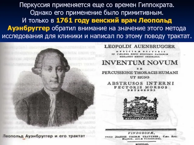 Перкуссия применяется еще со времен Гиппократа. Однако его применение было примитивным. И