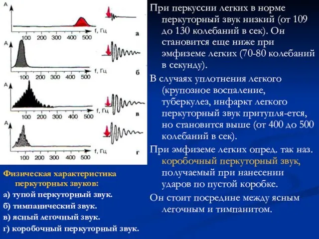 Физическая характеристика перкуторных звуков: а) тупой перкуторный звук. б) тимпанический звук. в)