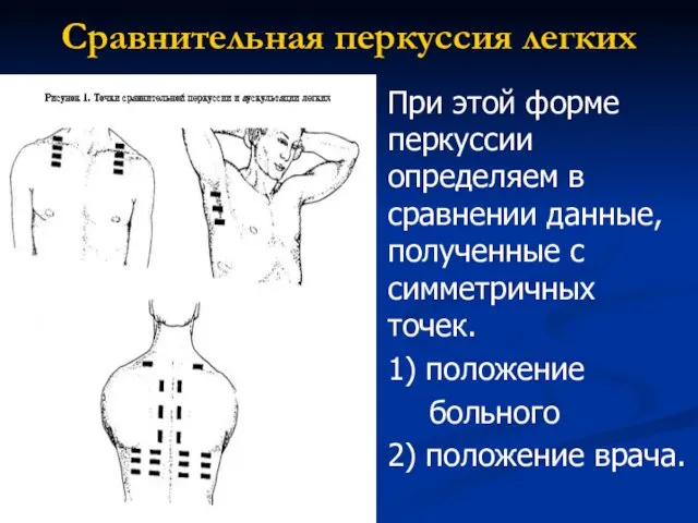 Сравнительная перкуссия легких При этой форме перкуссии определяем в сравнении данные, полученные