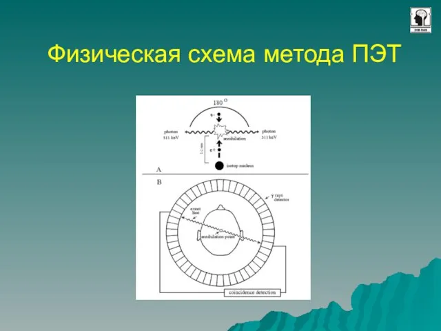 Физическая схема метода ПЭТ