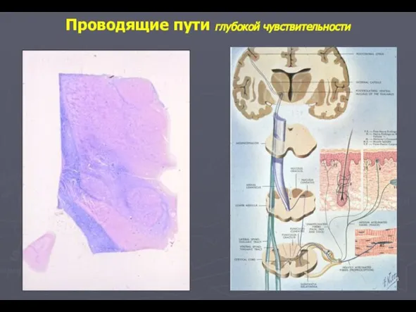 ТН Проводящие пути глубокой чувствительности