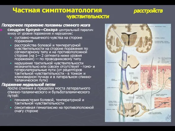 Поперечное поражение половины спинного мозга синдром Броуна—Секара центральный паралич книзу от уровня